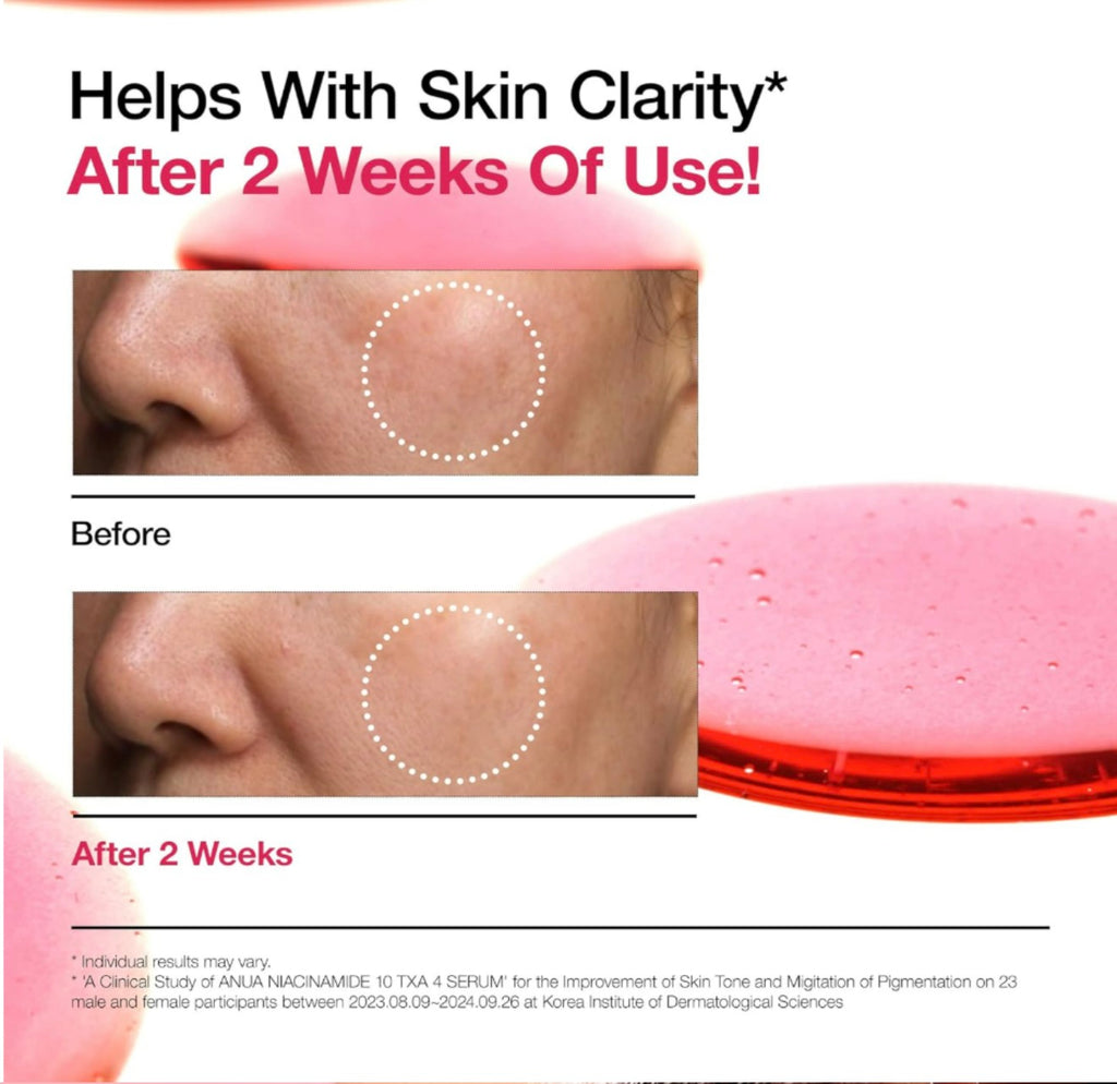 ANUA Niacinamide 10% +TXA 4% Dark Spot Correcting Serum 美白淡斑祛暗瘡印精華