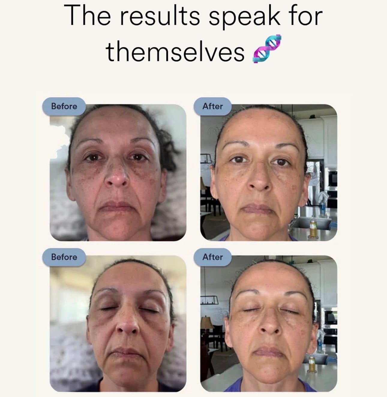 N A D+ Anti-Aging & Fatigue-Improving Beauty Patches 抗衰老改善疲勞美肌貼