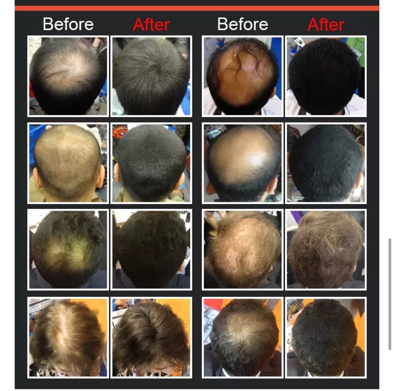 Dexe Hair Building Fiber Powder Dexe增髮纖維粉