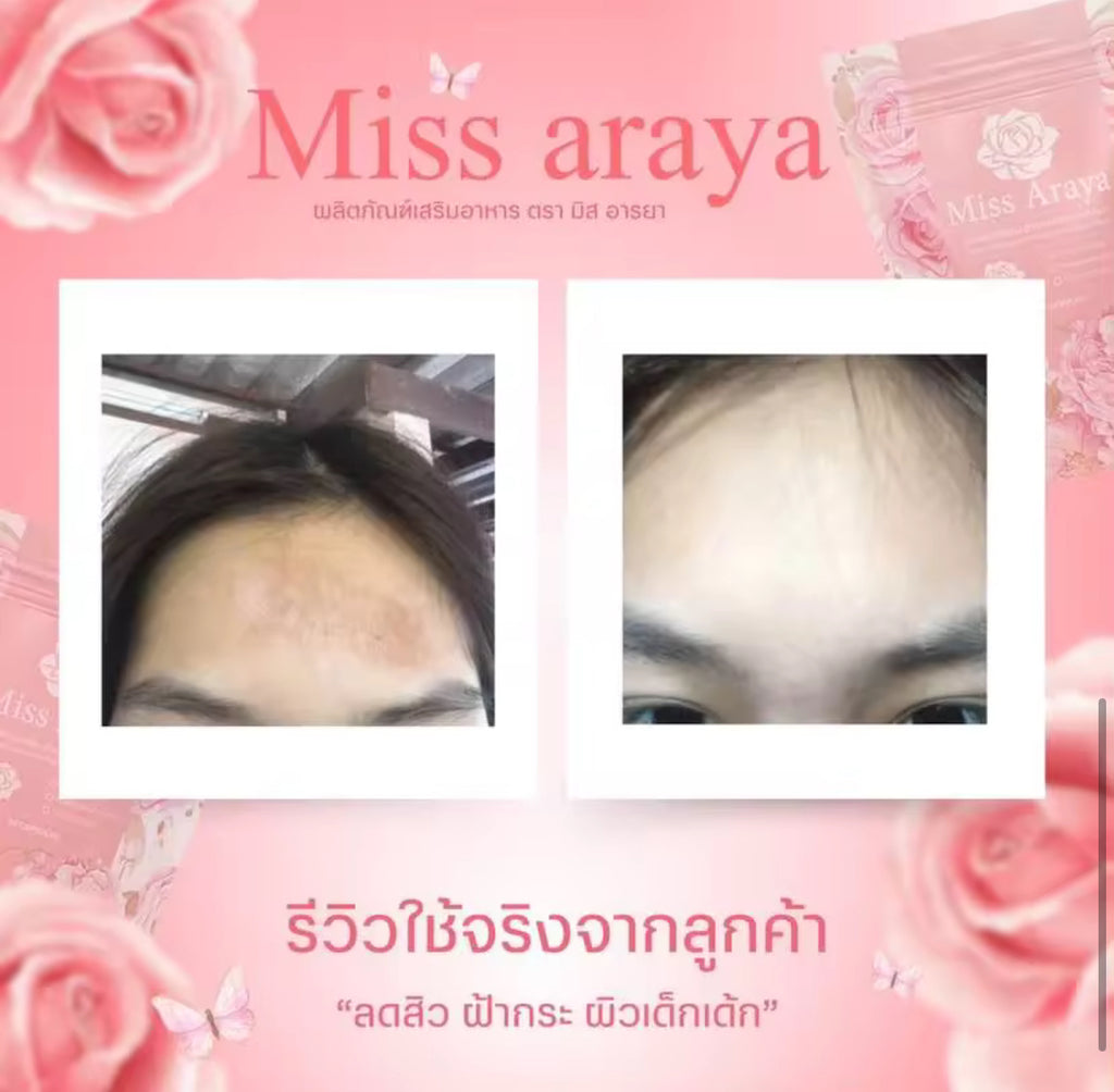 MISS ARAYA Women’s Probiotic Capsules 女性益生菌膠囊（20Capsules）