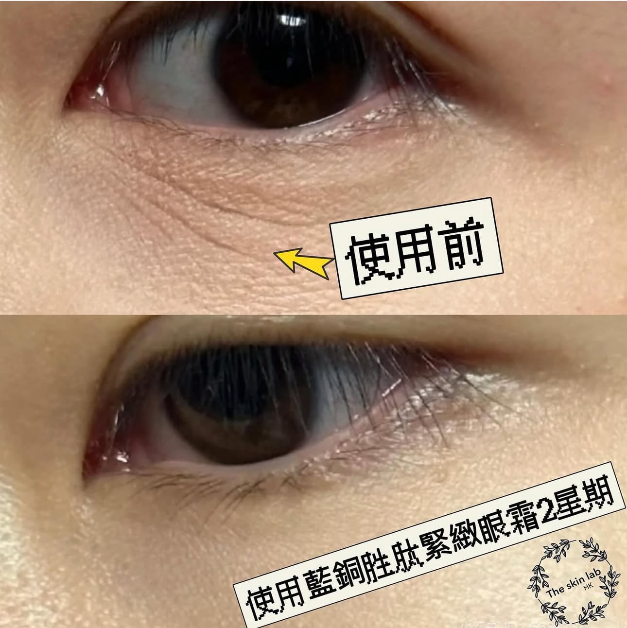 THE SKIN LAB HK Blue Copper Peptide Firming Eye Cream 藍銅胜肽緊緻眼霜
