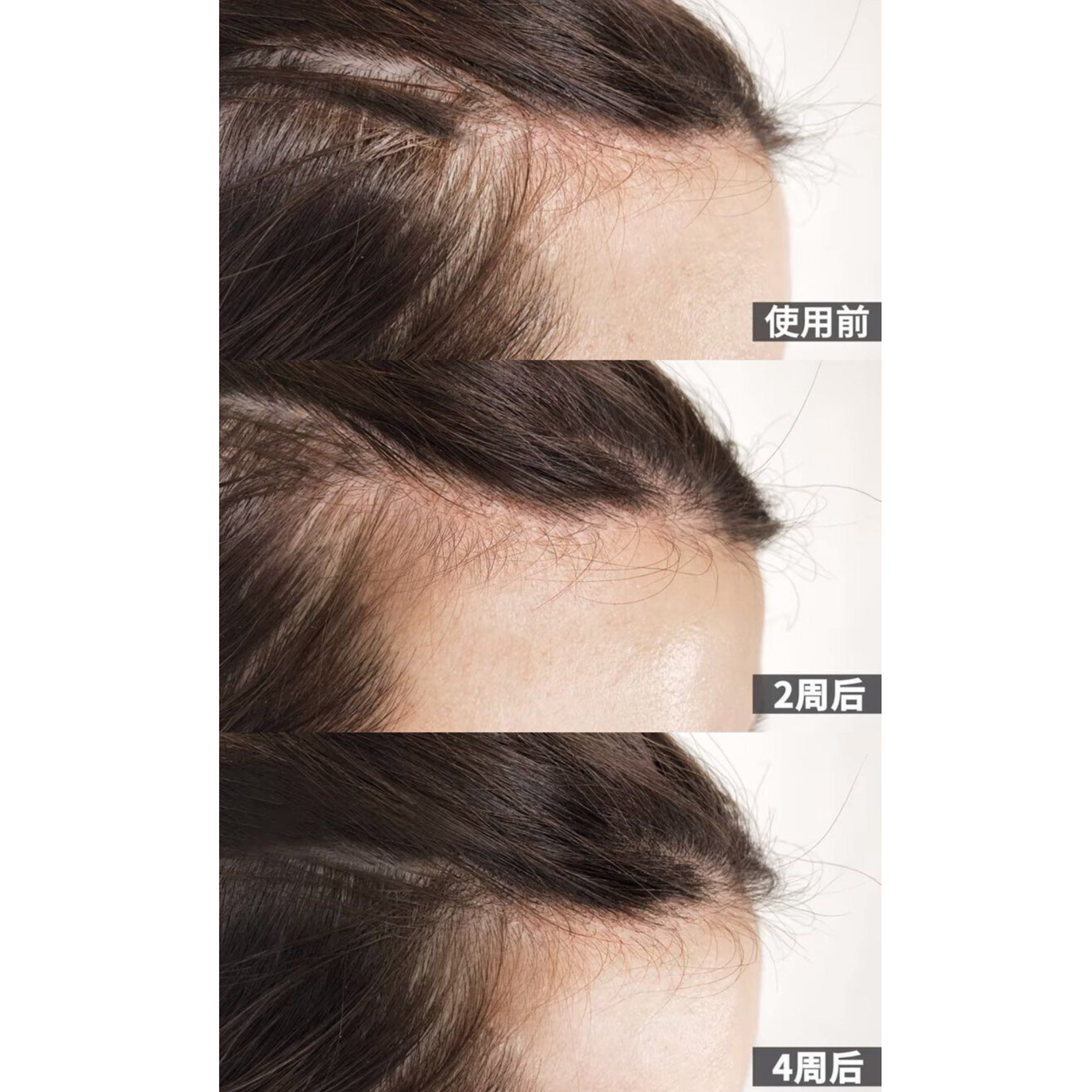 Daycell MBA Hair Growth Concentrate Roller Ball 生髮濃縮精華滾珠